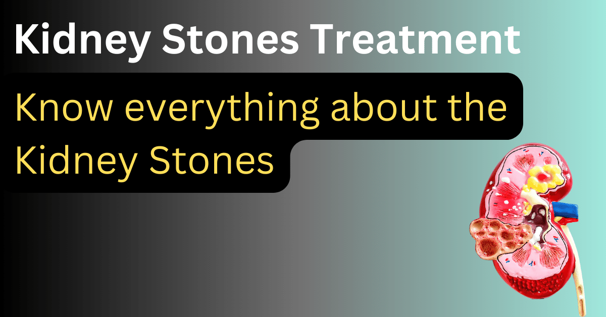 Kidney Stones Treatment