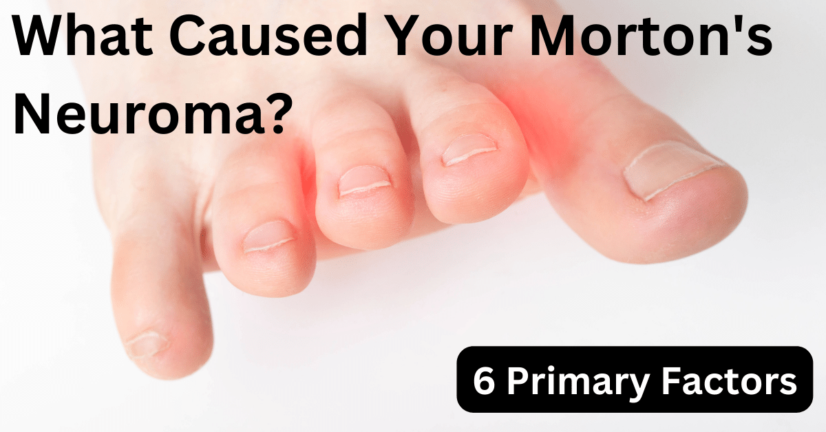 What Caused Your Morton's Neuroma?