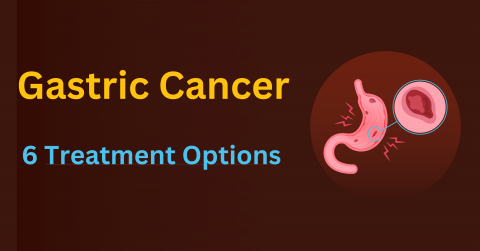gastric cancer treatment options 