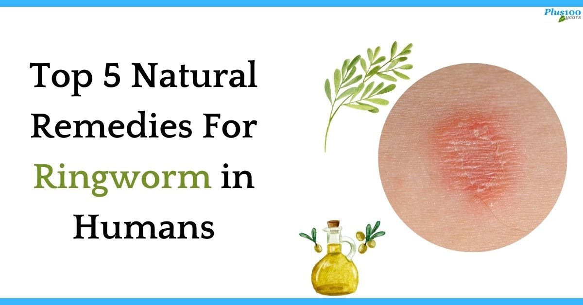 natural remedies for ringworm